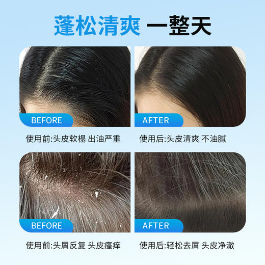 送干发帽 | 韩国原装进口TS帝叶斯 防脱/控油蓬松/染烫修复鱼腥草洗发水、鱼腥草护发素500ml 商品图11