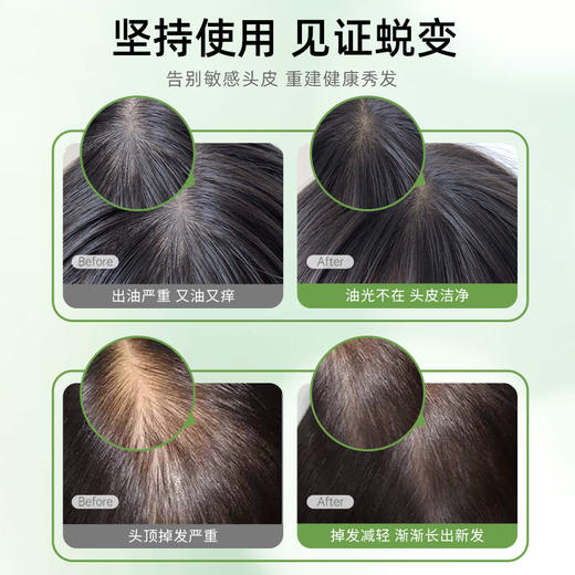 送干发帽 | 韩国原装进口TS帝叶斯 防脱/控油蓬松/染烫修复鱼腥草洗发水、鱼腥草护发素500ml 商品图10