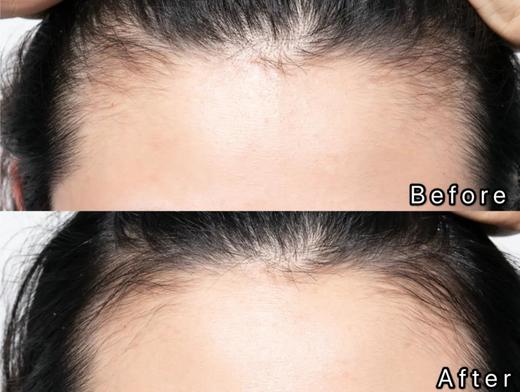 【5.12王炸割肉价】Grow Gorgeous强效增发精华60ml/瓶（限24年12月） 商品图2