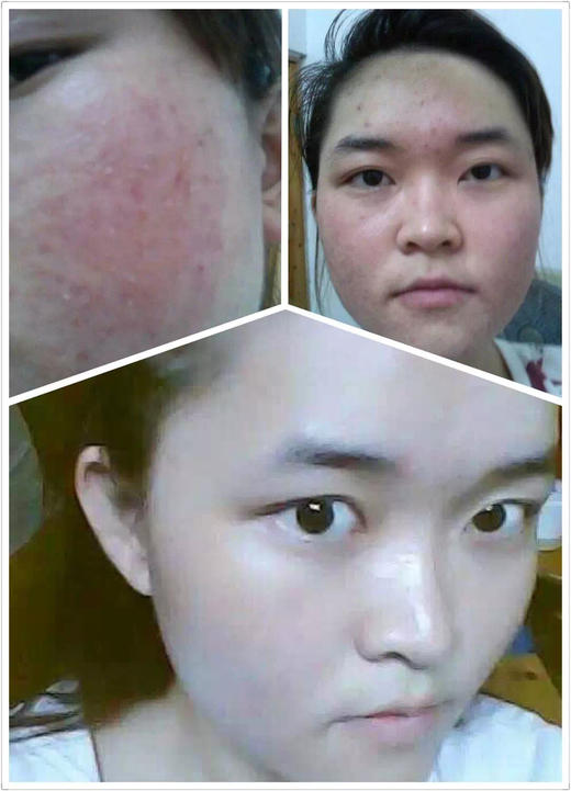 【补水急救维稳面膜组合】十余年口碑海藻胶舒润冰冰膜五片盒装 自家创新专利海藻多糖体成膜 上脸30-60分钟，旅游出行长时间户外必备：海藻胶蓝是来自栀子果提取 商品图10