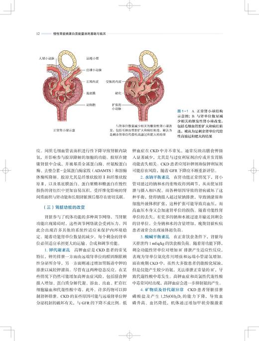 慢性肾脏病蛋白质能量消耗基础与临床 丁巍 肾脏康复新理念技术方法 CKD PEW病生理机制临床评估 上海科学技术出版社9787547865644 商品图4