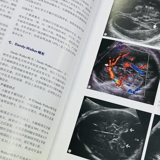 正版现货 24年新版 超声医学第七版7版 唐杰 郭万学 科学出版社 超声医师专业书参考工具书超声医学基础诊断超声治疗9787508863801 商品图4