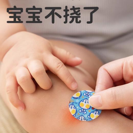 绿鼻子紫草舒缓贴婴儿专用儿童宝宝蚊虫叮咬非止痒膏 商品图3