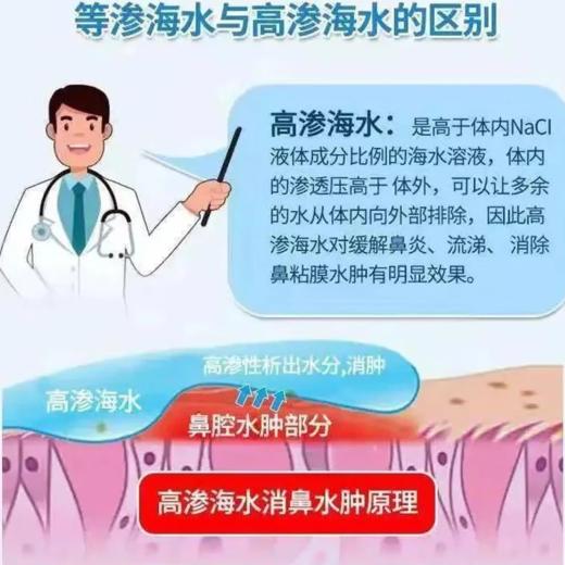 鼻诺鼻腔喷雾器 儿童型 50ml/瓶 商品图2