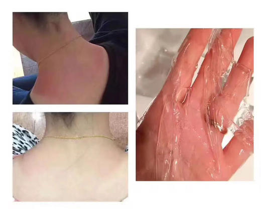 【补水急救维稳面膜组合】十余年口碑海藻胶舒润冰冰膜五片盒装 自家创新专利海藻多糖体成膜 上脸30-60分钟，旅游出行长时间户外必备：海藻胶蓝是来自栀子果提取 商品图8