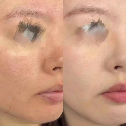 X-7靶向护肤系列 商品图4