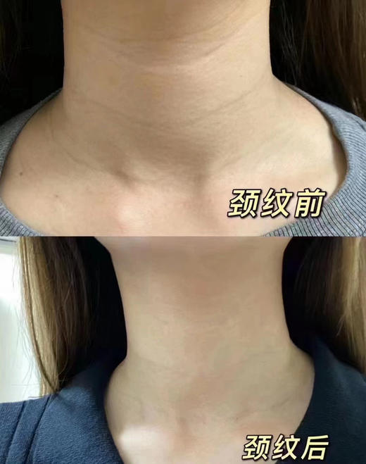 珈赞嗨颈  颈纹天鹅颈提拉紧致肌肤修复 静态纹改善 商品图8