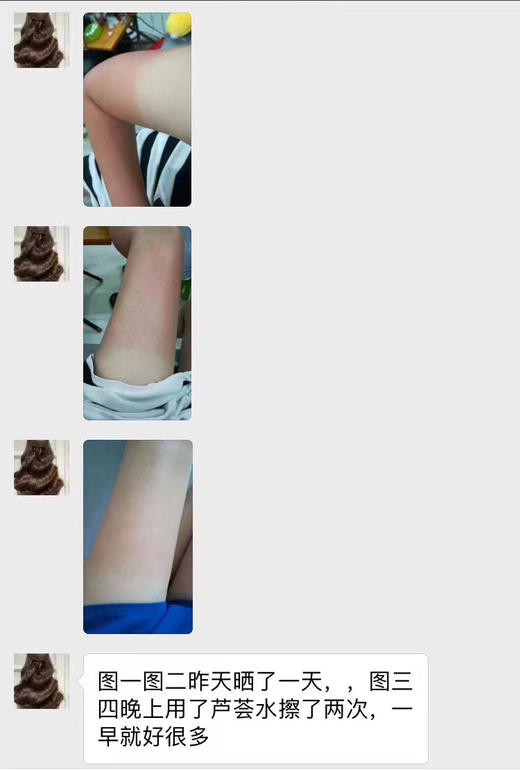 【新鲜入库，加送五个压缩面膜】300ml巨量芦荟水天芦荟叶水 紫球藻 雪耳萃取 生物糖胶和乳酸菌发酵产物 温和补水维稳 多元醇防腐体系不刺激 可以晒后水膜缓解，也可以妆前局部快速湿敷服帖上妆 商品图4