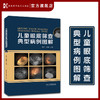 儿童眼底筛查典型病例图解 儿童眼病专家李芸教授 儿童眼底病例速查  湖南科学技术出版社 商品缩略图0