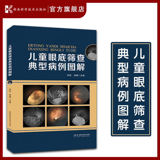 儿童眼底筛查典型病例图解 儿童眼病专家李芸教授 儿童眼底病例速查  湖南科学技术出版社 商品图0