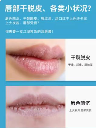 小蓝罐修复润唇膏 商品图2