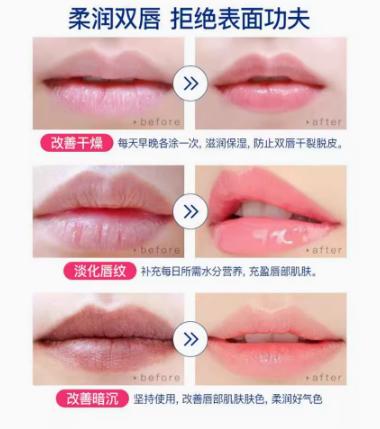 DHC蝶翠诗橄榄护唇-草莓味 商品图1