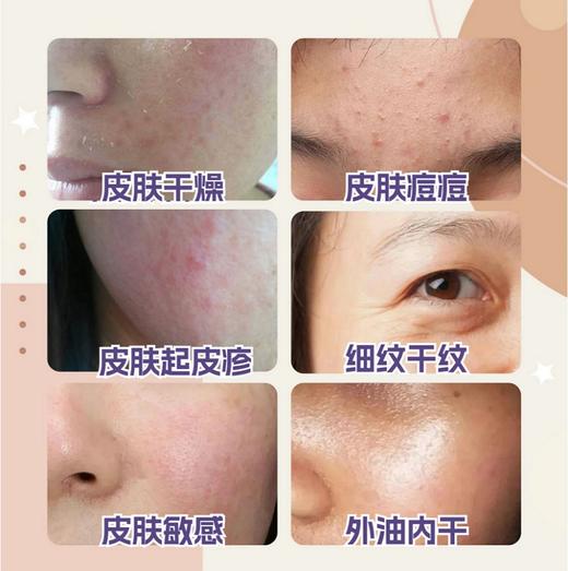 RIUE奢润修护舒缓精华乳30ml 商品图6