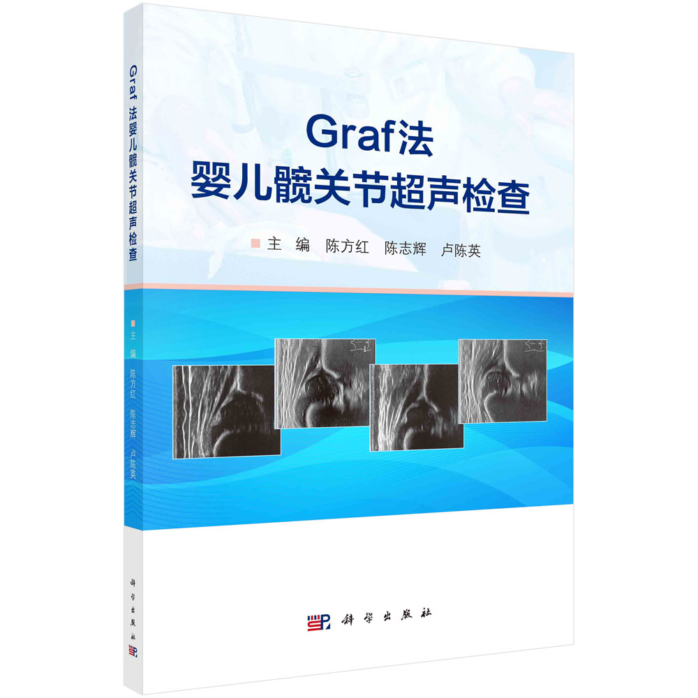 【官方直发】Graf法婴儿髋关节超声检查