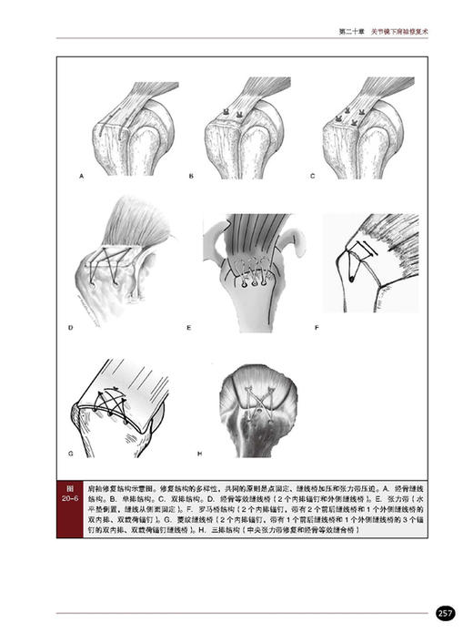 肩部与肘部 美国骨科医师学会骨科知识更新 查晔军主译 骨科 创伤骨科肩肘外科学 肩袖修复 AAOS 北京科学技术出版社9787571431563 商品图4