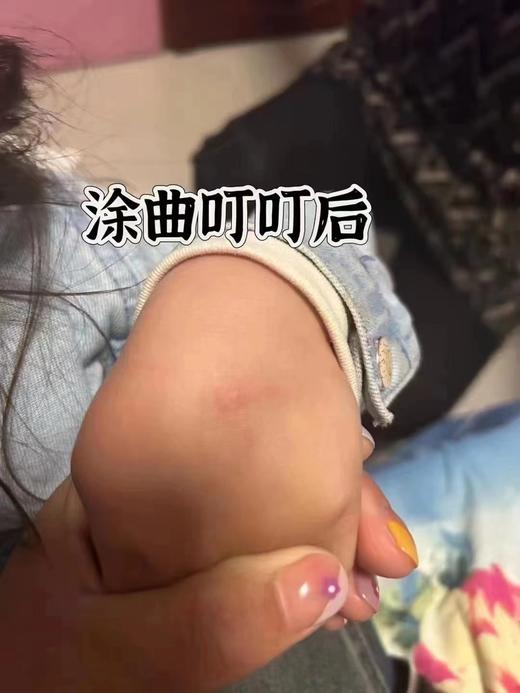 【Little siinboo小城堡孕婴】B8F 曲叮叮儿童保护霜 2支/3支 商品图3