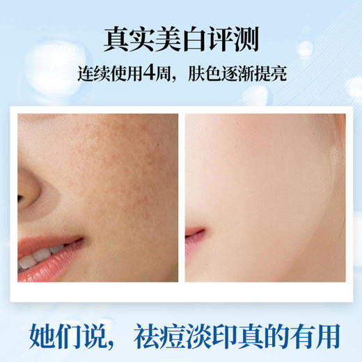 美白祛斑精华液·50ml 美白肌肤修护暗沉淡化黑色素改善发黄祛斑亮肤【联名款】 商品图3