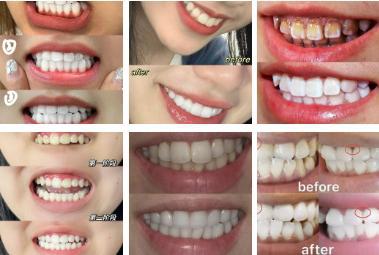 i22VifOtztSBuvrBbg2QeT4ldYZgaHJRvCCi