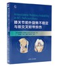 膝关节前外旋转不稳定与前交叉韧带损伤 商品缩略图0