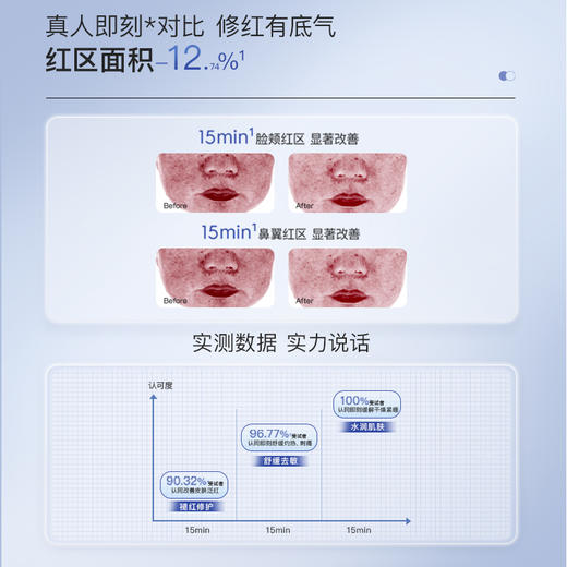 绽媄娅 钝感力面膜修护舒缓保湿抗皱紧致5片/盒 商品图1