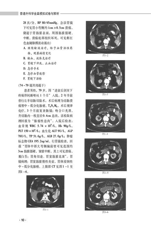 普通外科学全真模拟试卷与解析 高级卫生专业技术资格考试用书 英腾教育高级职称教研组编写 中国医药科技出版社9787521445763  商品图4