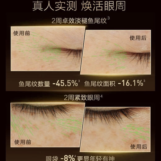 法国 L'OREAL欧莱雅 黑金松露抗老紧致眼霜 20ml 商品图1