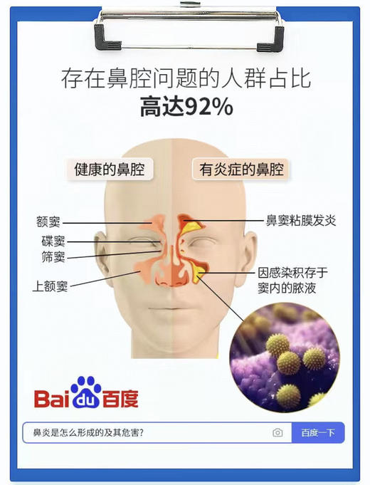 【VSKA鼻通贴】对付鼻塞它是真的牛知通过穴位贴敷刺激，仅仅10s就可通鼻 商品图3