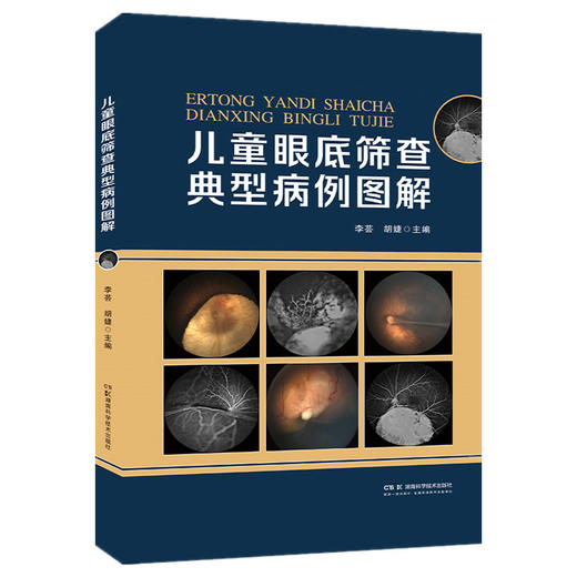 儿童眼底筛查典型病例图解 商品图0