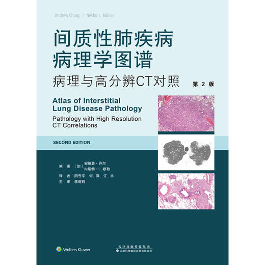 间质性肺疾病病理学图谱：病理与高分辨CT对照（第2版）  间质性肺疾病 病理学 商品图3