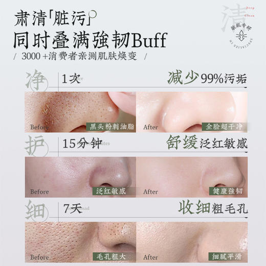 儒意维生素原B5水杨酸泥膜100g 清洁泥膜去黑白头闭口粉刺收缩深层清洁毛孔涂抹式积雪草清洁面膜|儒意官方商城 商品图5