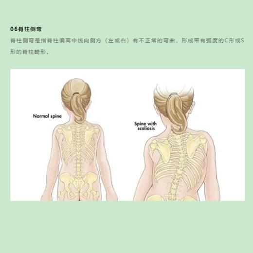 青少年体态健康科普 商品图7
