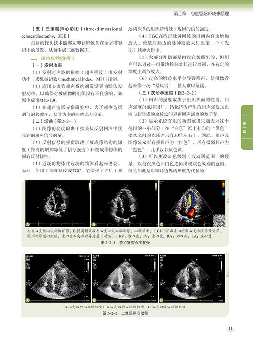 临床超声心电图诊断学 上册 附动图视频 张全斌 江勇 心血管超声特征检查方法注意事项 临床病例 科学技术文献出版社9787523512425 商品图4