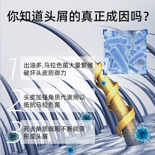 bvzip洗发水去屑止痒控油无硅油二硫化硒洗发露 商品图3