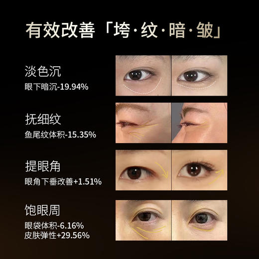 “名后4D高浓精雕眼霜”，直击眼部浮肿、松垮、多细纹、黑眼圈等问题，一瓶为你消除年龄魔“皱”！ 商品图3
