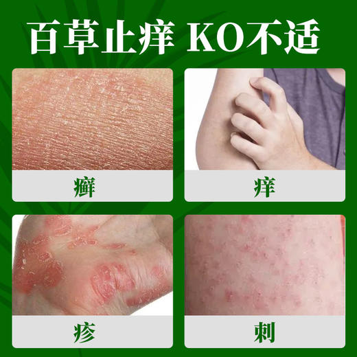 【湿疹止痒】云南本草百草止痒膏 湿疹成人止痒外用皮肤瘙痒膏 四季常备 防止皮肤瘙痒 商品图1