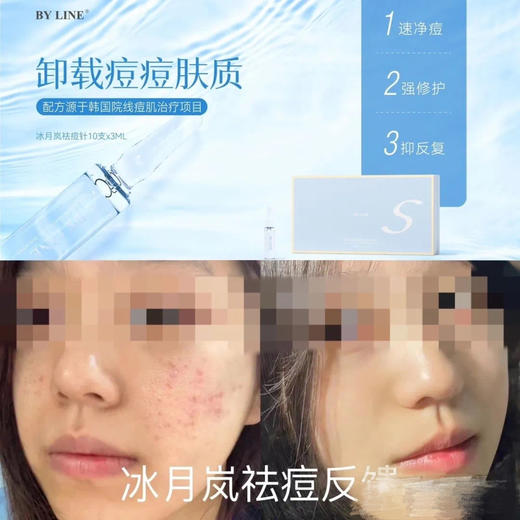 冰月岚净痘3ml加三文鱼婴儿针 淡化痘印痘 商品图4