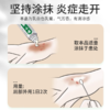 【湿疹止痒】云南本草百草止痒膏 湿疹成人止痒外用皮肤瘙痒膏 四季常备 防止皮肤瘙痒 商品缩略图3