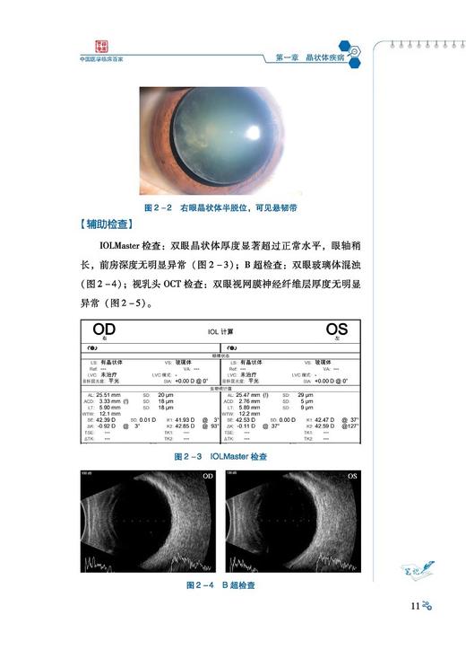 重庆大坪医院眼科病例精解 中国医学临床百家 病例精解 眼眶泪道病及眼整形 斜视及屈光疾病 科学技术文献出版社9787523512074  商品图4