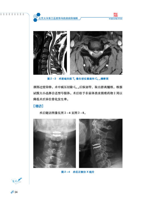 北京大学第三医院骨科疾病病例精解 刘忠军 中国医学临床百家病例精解 剖析临床诊疗思路总结经验9787523512067科学技术文献出版社 商品图4