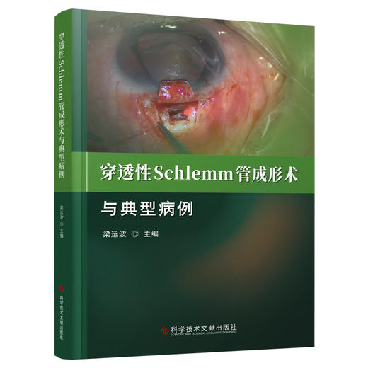 穿透性Schlemm管成形术与典型病例 梁远波主编 青光眼眼外科手术操作 临床应用典型病例研究分析 科学技术文献出版社9787523513569 商品图1