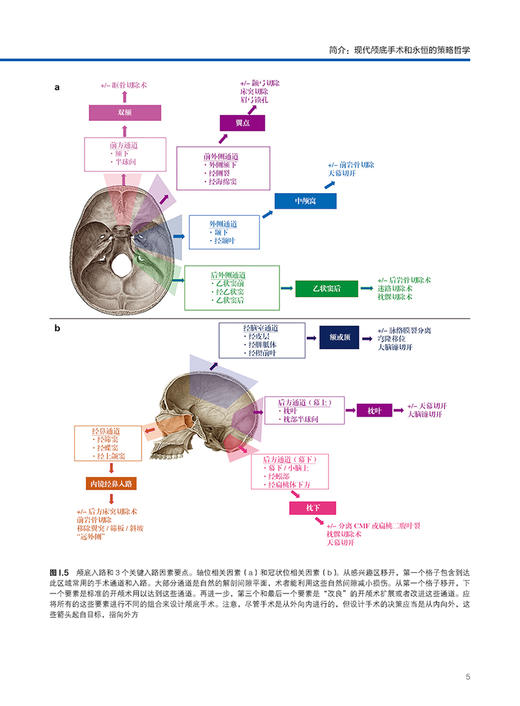 颅底手术策略 附视频 黄国栋主译 颅底肿瘤生物学特征 汇集著名神经外科专家治疗理念执行策略 辽宁科学技术出版社9787559131812 商品图3