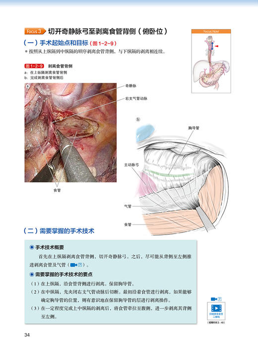 上消化道癌标准手术图谱 附视频 孙凌宇 赵岩 王权主译 消化系肿瘤上消化道疾病外科手术操作方法9787559134349辽宁科学技术出版社 商品图3