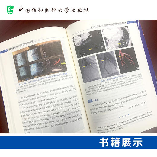 球囊肺血管成形术在CTEPH中的应用 包含流行病学特征 危险因素 病理生理学特点 发病机制等 中国协和医科大学出版社9787567923553  商品图2