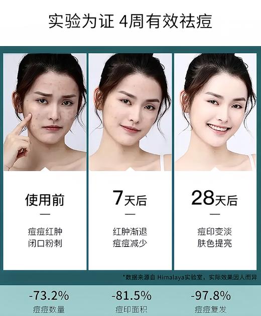【中欧班列精选】印度西玛啦雅Himalaya痘痘修复霜30g/支 cs 商品图4