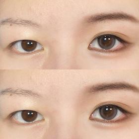 肿眼泡❗ OUT ❗ ❗