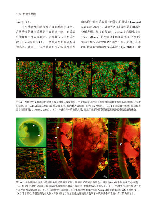 根管生物膜 叶惟虎主译 聚焦于根管系统内细菌生物膜感染机制及其控制策略 口腔科学牙体牙髓书籍9787559131881辽宁科学技术出版社 商品图3