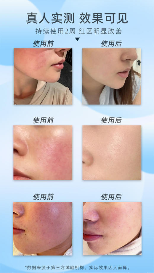 【拾光肌因】白细胞舒缓精油 商品图5