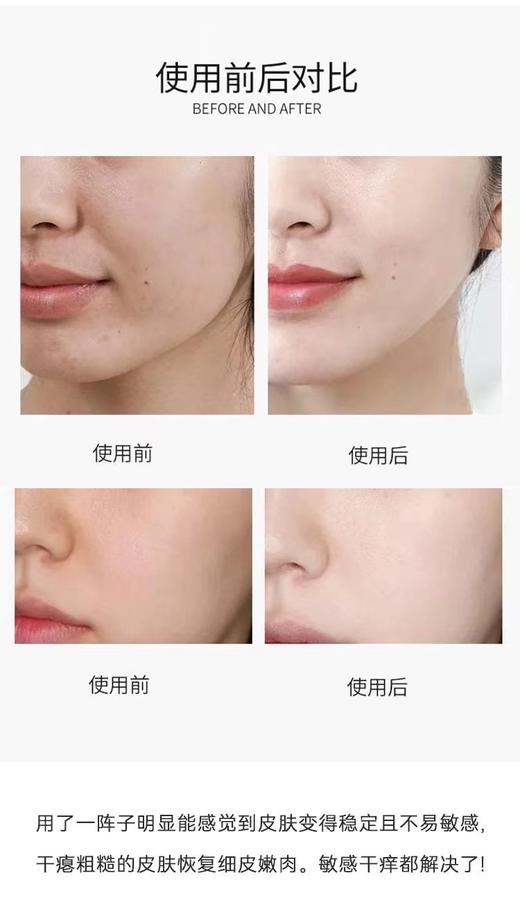 资生堂（Shiseido）悦薇珀翡紧颜亮肤水乳 滋润型套装（150ml+100ml) 商品图7