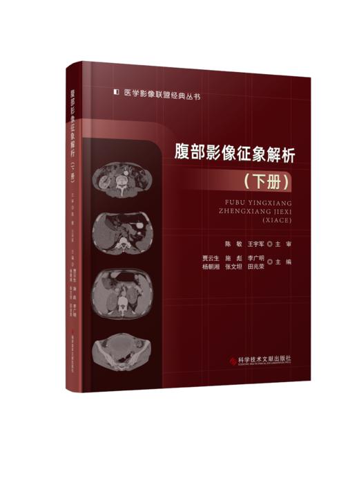 现货  腹部影像征象解析（上册）腹部影像征象解析（下册） 商品图2