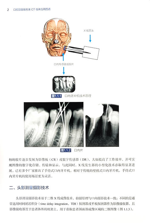 口腔颌面锥形束CT临床应用图谱 本书是供口腔医 护 技人员阅读的锥形束CT CBCT 入门级读物 北京大学医学出版社9787565931017 商品图4